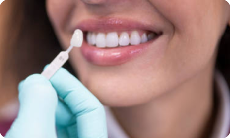 Veneers Procedure