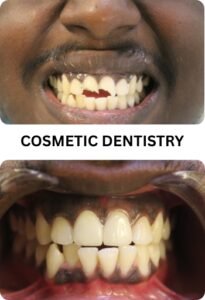 COSMETIC DENTISTRY before after