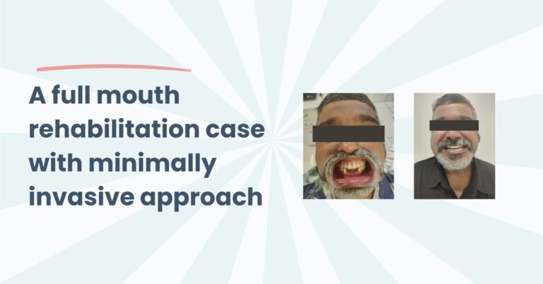 Full Mouth Rehabilitation