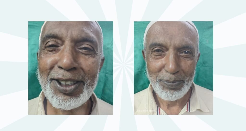 Patient Happy full mouth