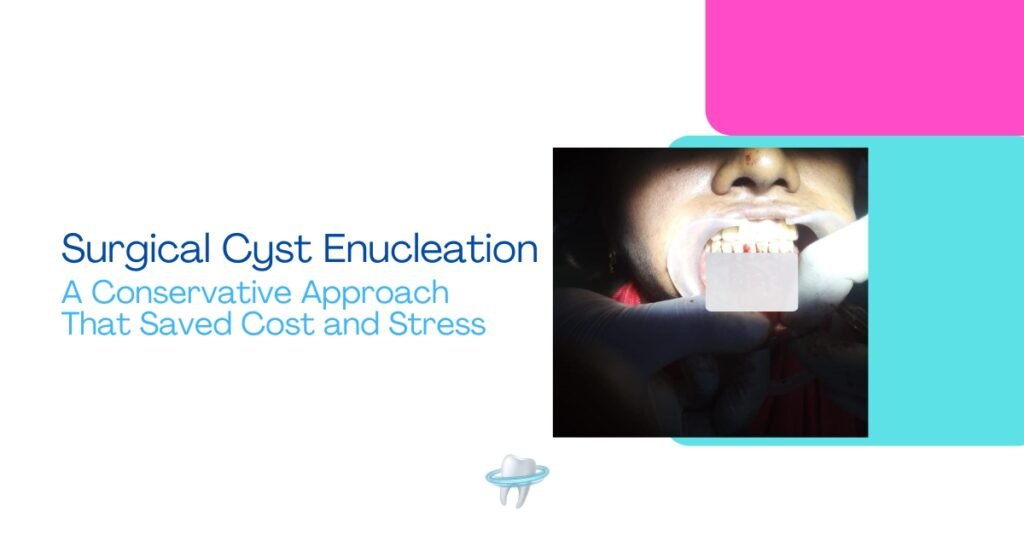 Surgical Cyst Enucleation