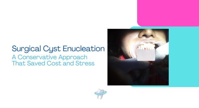 Surgical Cyst Enucleation