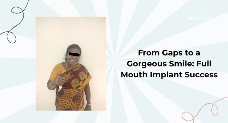 From Gaps to a Gorgeous Smile: Full Mouth Implant Success