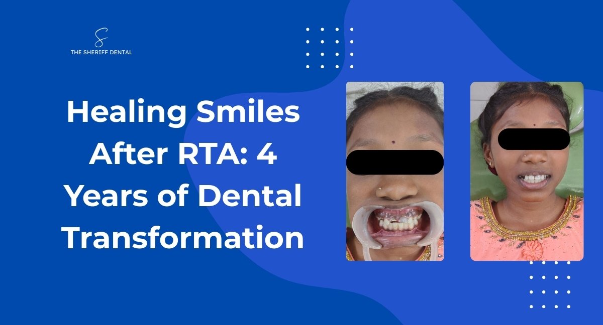 Healing Smiles After RTA: 4 Years of Dental Transformation
