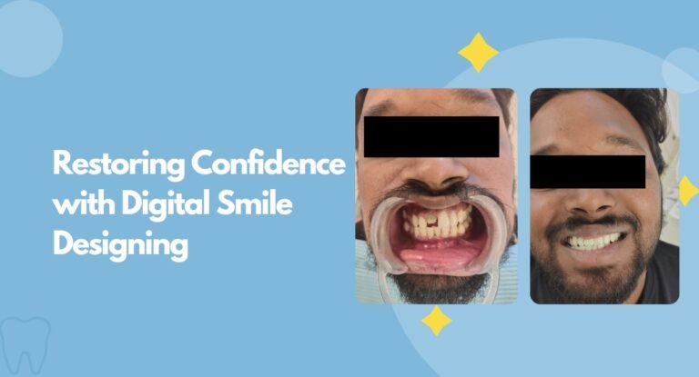 Restoring Confidence with Digital Smile Designing