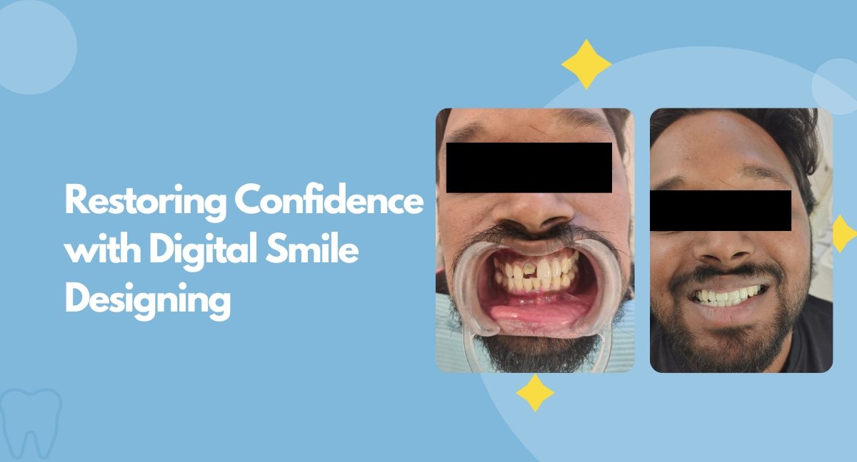 Restoring Confidence with Digital Smile Designing