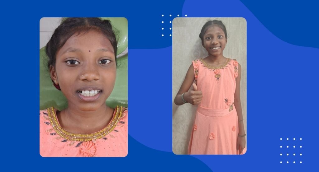 minimally invasive esthetic rehabilitation