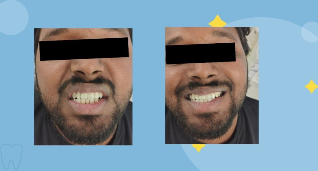 aesthetic improvement