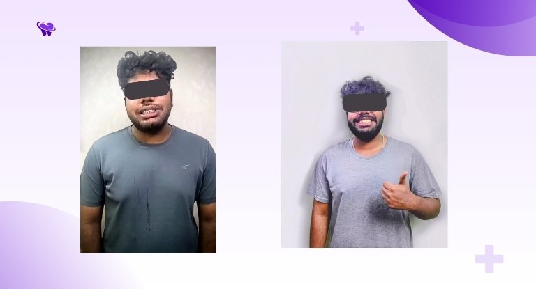  successfully achieve this