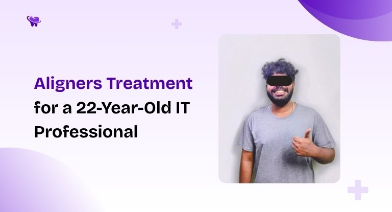 Aligners Treatment for a 22-Year-Old IT Professional