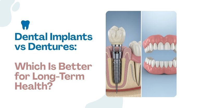 Dental Implants vs Dentures