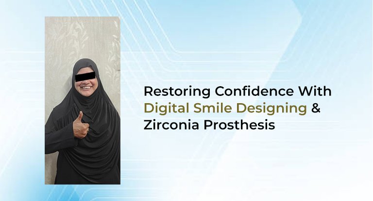 Digital Smile Designing & Zirconia Prosthesis