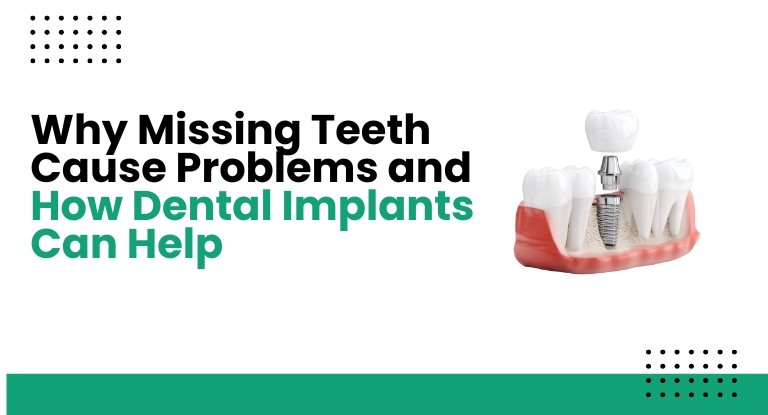 Why Missing Teeth Cause Problems and How Dental Implants Can Help